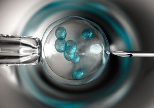 Image of ICSI — Find and IVF Specialist in Ontario